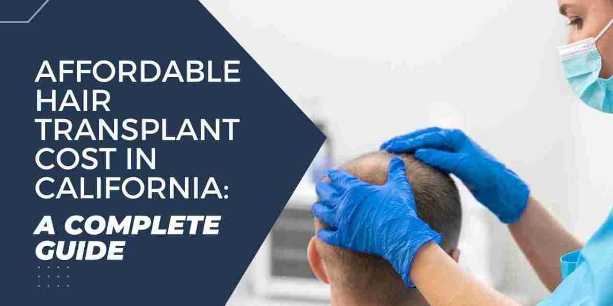 Affordable Hair Transplant Cost in California: A Complete Guide