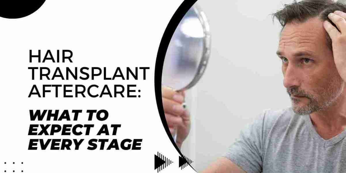 Hair Transplant Aftercare: What to Expect at Every Stage