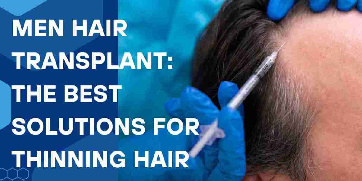 Men Hair Transplant: The Best Solutions for Thinning Hair